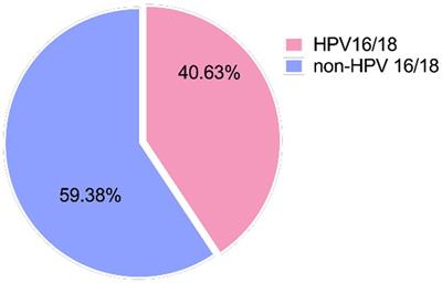 Effects of 5-aminolevulinic acid photodynamic therapy for cervical low-grade squamous intraepithelial lesions with HR-HPV infections